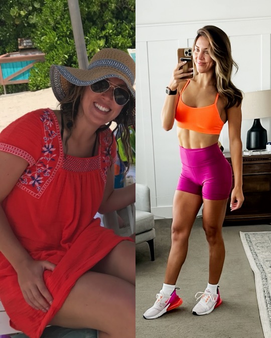 Elyse before and after Daily Lift